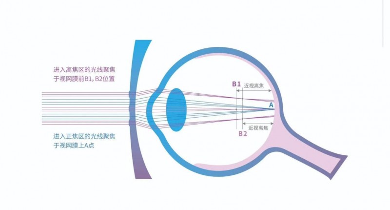 暑假过半,孩子视力还撑得住吗?医生:开学前这件事千万别忘